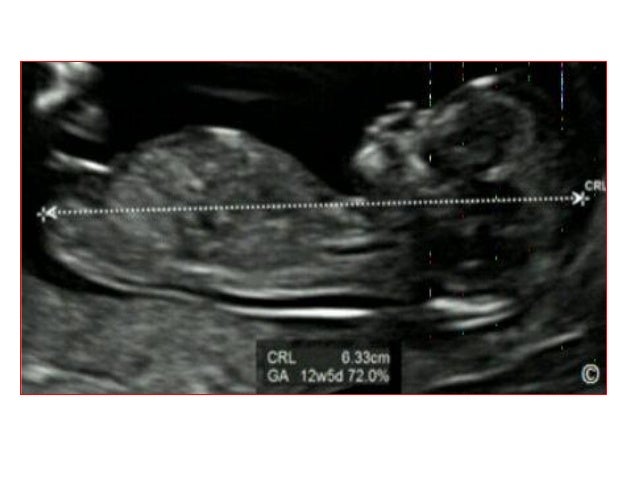 Sex chat on text What is the purpose of a dating ultrasound